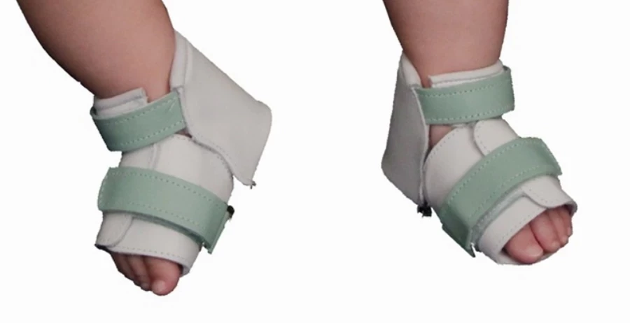 buty-korygujace-deformacje-stop-u-dzieci-bebax-prim-jana-pawla-ii-1-konstantynow-mk