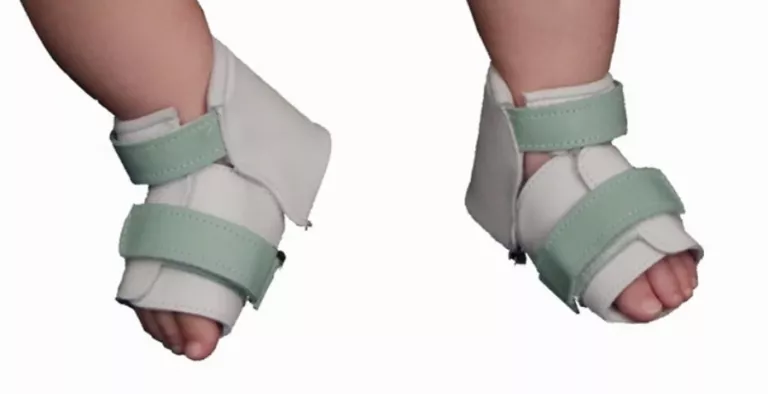 buty-korygujace-deformacje-stop-u-dzieci-bebax-prim-jana-pawla-ii-1-konstantynow-mk