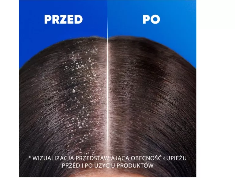 HEAD SHOULDERS CITRUS FRESH SZAMPON PRZECIWŁUPIEŻOWY 800 ML Z POMPKĄ