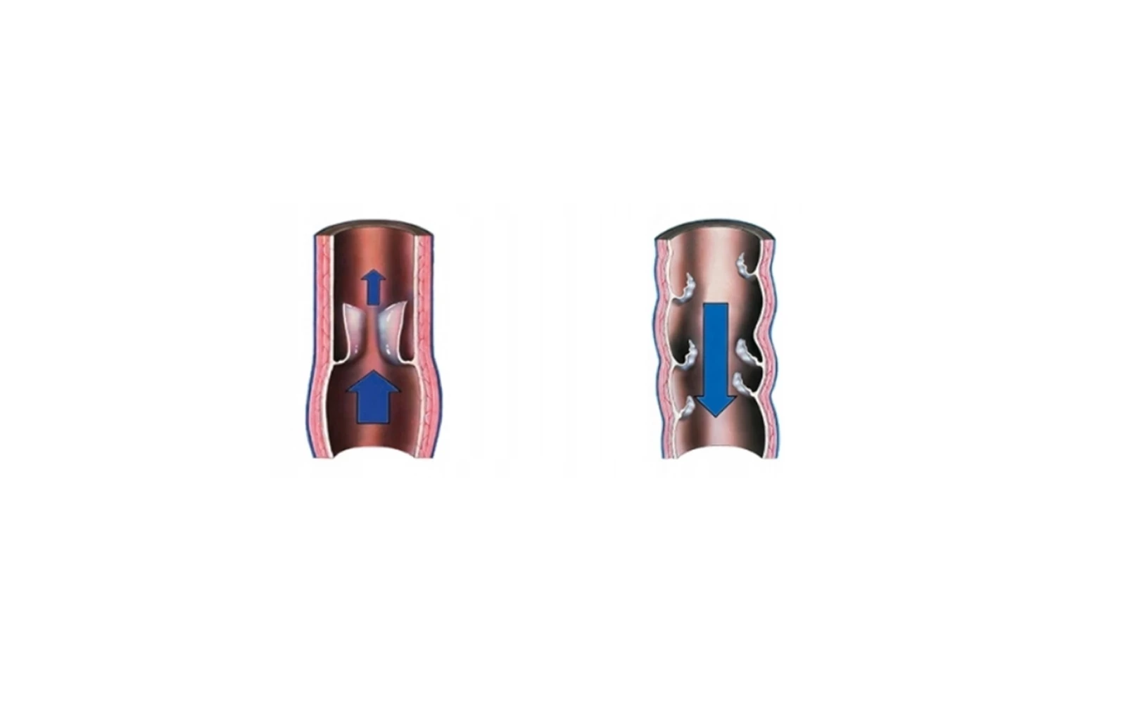 podkolanowki-uciskowe-jobst-opaque-skarpety-kompresyjne-zylaki-ccl1-r3-rozmiar-229093-340225