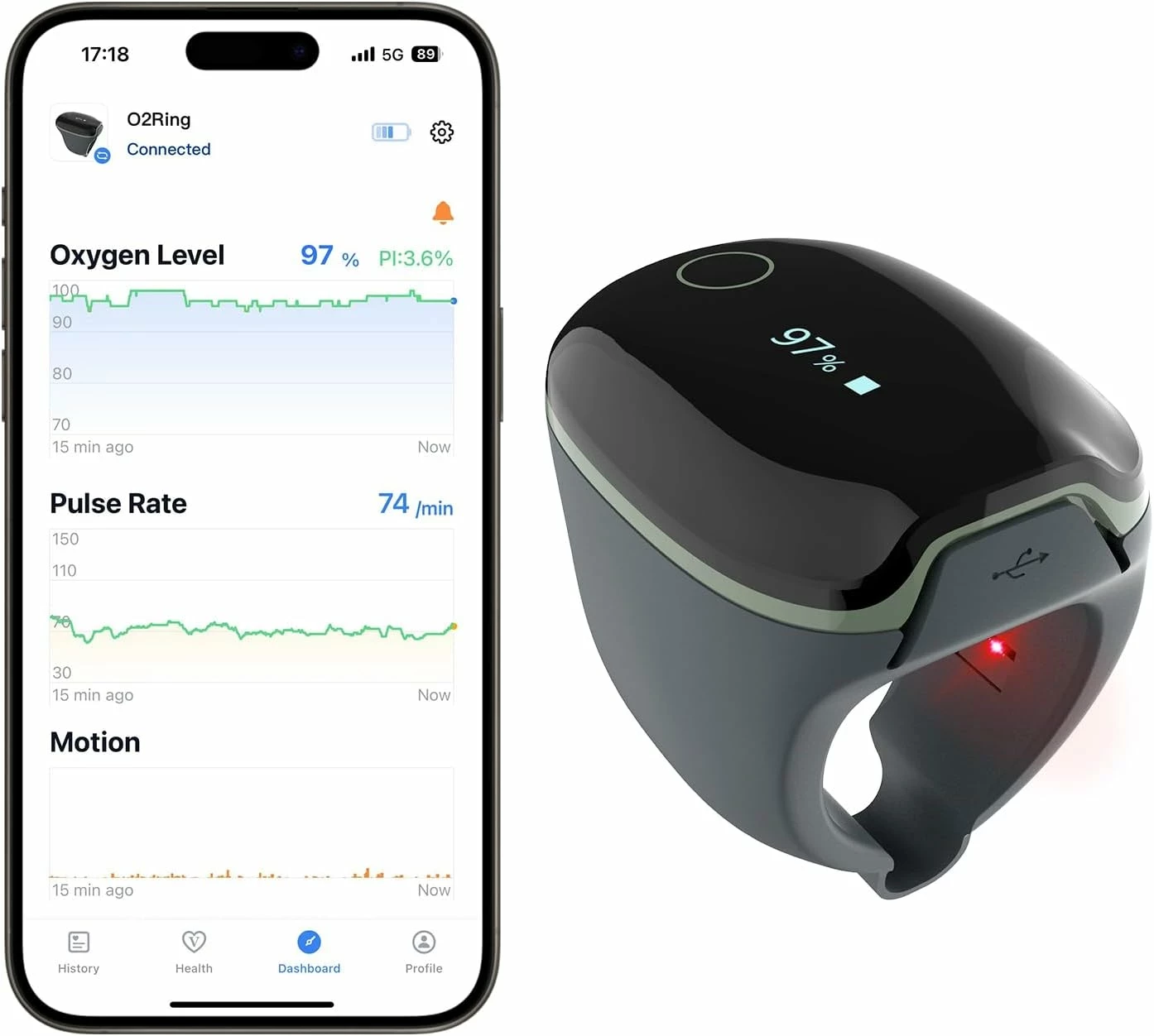 wellue-viatom-o2ring-pulsoksymetr-na-palec-do-ciaglego-monitorowania-legionow-3-grudziadz